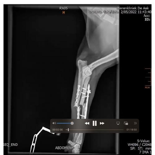 Webinar Fracture Management - Meet the Specialist